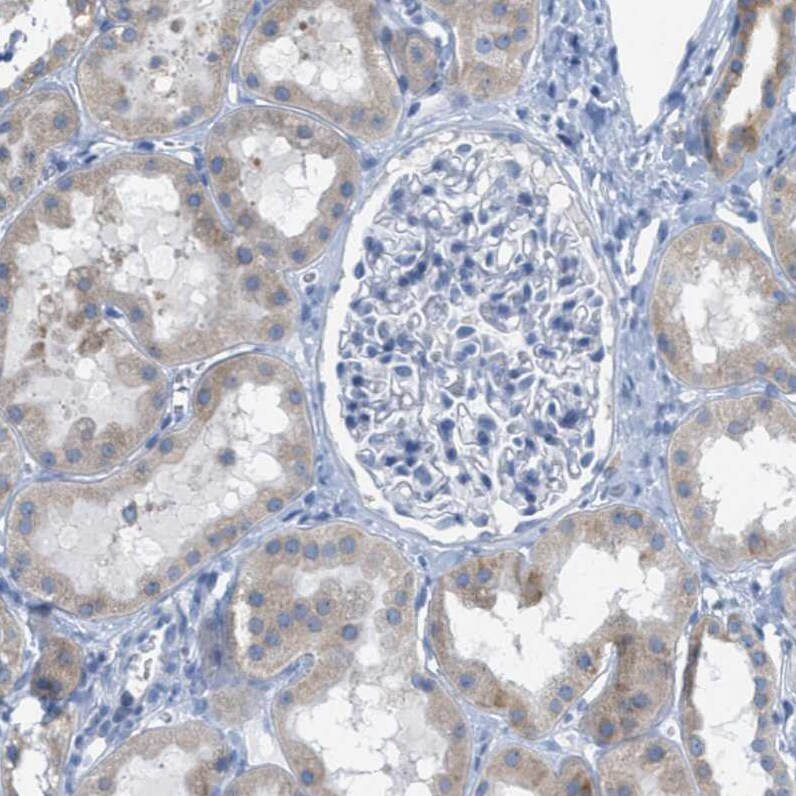 Testis expressed 264 Antibody - BSA Free Immunohistochemistry-Paraffin: Testis expressed 264 Antibody - BSA Free [NBP1-89866]