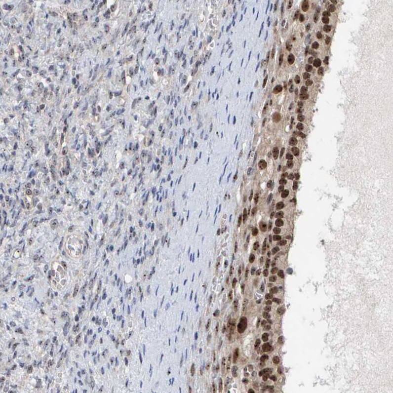 PRAF1 Antibody - BSA Free Immunohistochemistry-Paraffin: PRAF1 Antibody - BSA Free [NBP1-89867]