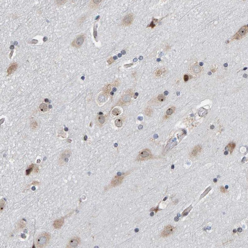 PRAF1 Antibody - BSA Free Immunohistochemistry-Paraffin: PRAF1 Antibody - BSA Free [NBP1-89867]