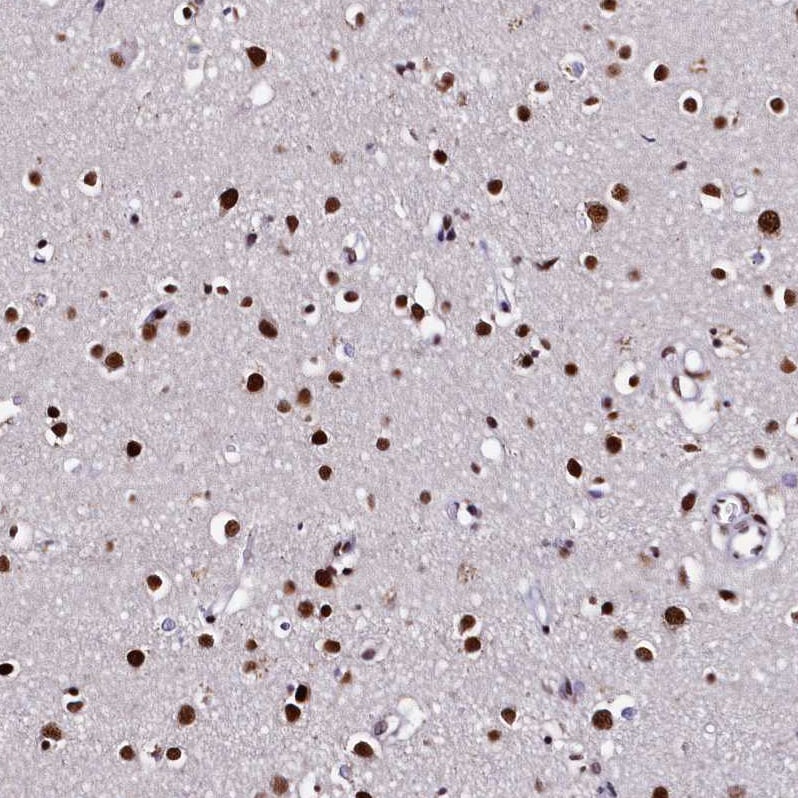 pre-mRNA cleavage factor I (59 kDa subunit) Antibody - BSA Free Immunohistochemistry-Paraffin: pre-mRNA cleavage factor I (59 kDa subunit) Antibody - BSA Free [NBP1-89868]