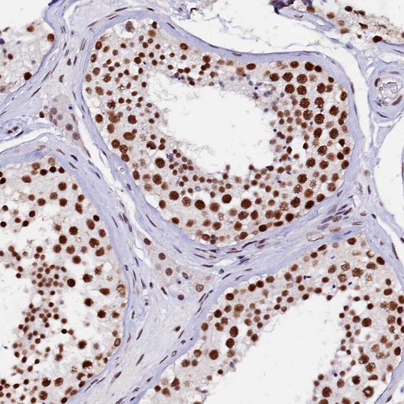 pre-mRNA cleavage factor I (59 kDa subunit) Antibody - BSA Free Immunohistochemistry-Paraffin: pre-mRNA cleavage factor I (59 kDa subunit) Antibody - BSA Free [NBP1-89868]