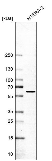 pre-mRNA cleavage factor I (59 kDa subunit) Antibody - BSA Free Western Blot: pre-mRNA cleavage factor I (59 kDa subunit) Antibody - BSA Free [NBP1-89868]