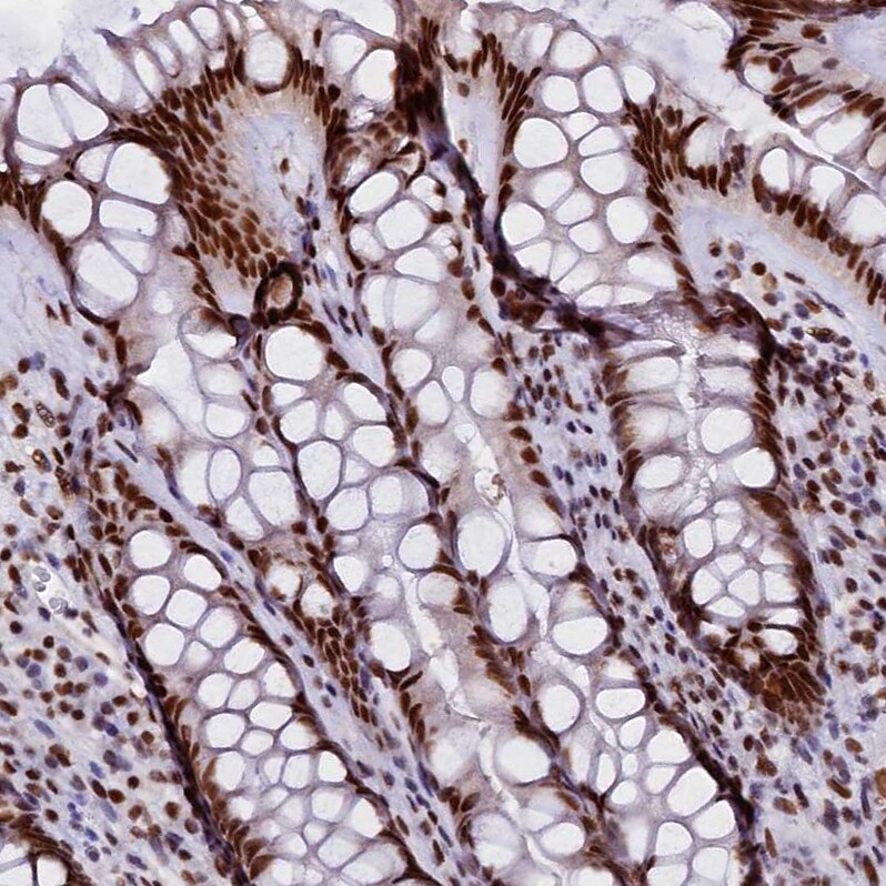 pre-mRNA cleavage factor I (59 kDa subunit) Antibody - BSA Free Immunohistochemistry-Paraffin: pre-mRNA cleavage factor I (59 kDa subunit) Antibody - BSA Free [NBP1-89868]