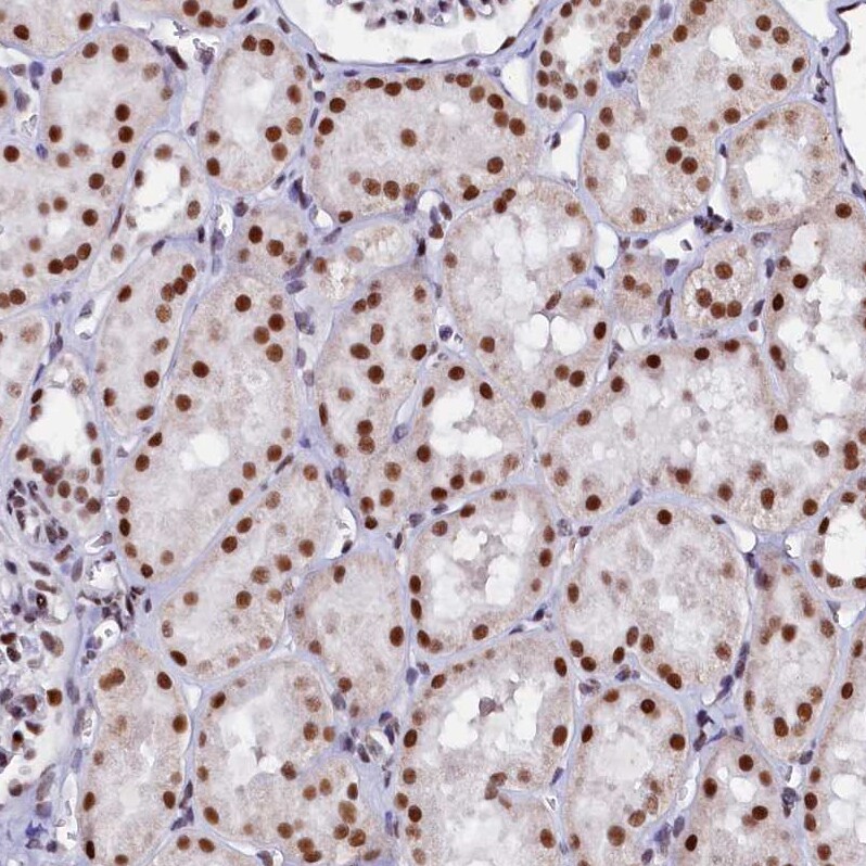 pre-mRNA cleavage factor I (59 kDa subunit) Antibody - BSA Free Immunohistochemistry-Paraffin: pre-mRNA cleavage factor I (59 kDa subunit) Antibody - BSA Free [NBP1-89868]