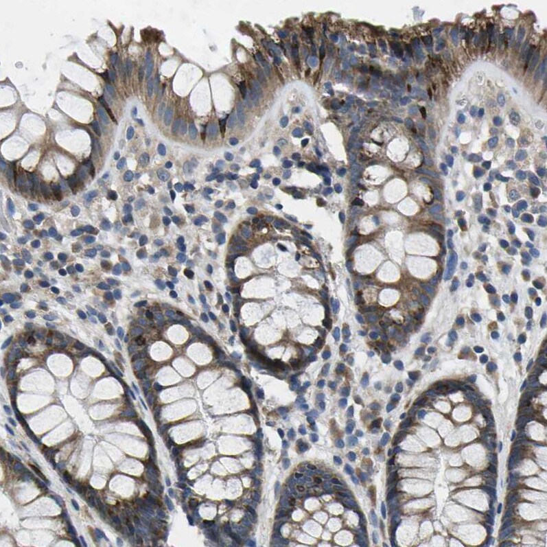 ERGI3 Antibody - BSA Free Immunohistochemistry-Paraffin: ERGI3 Antibody - BSA Free [NBP1-89881]