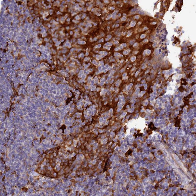 Kindlin Antibody - BSA Free Immunohistochemistry-Paraffin: Kindlin Antibody - BSA Free [NBP1-89883]