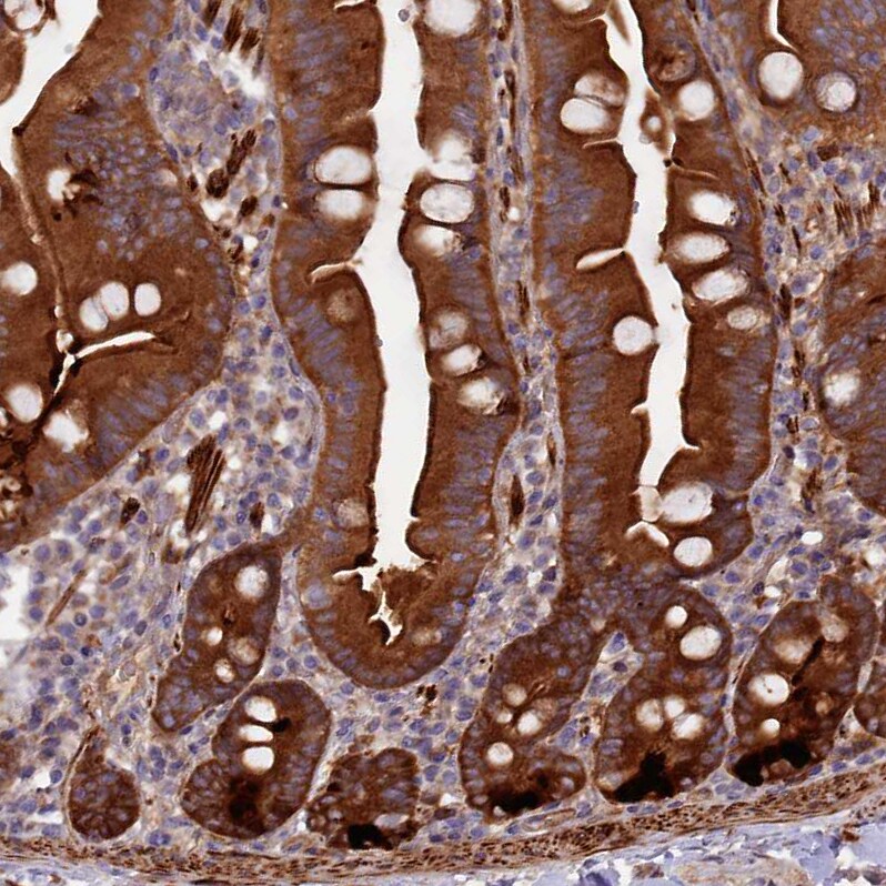 Kindlin Antibody - BSA Free Immunohistochemistry-Paraffin: Kindlin Antibody - BSA Free [NBP1-89883]