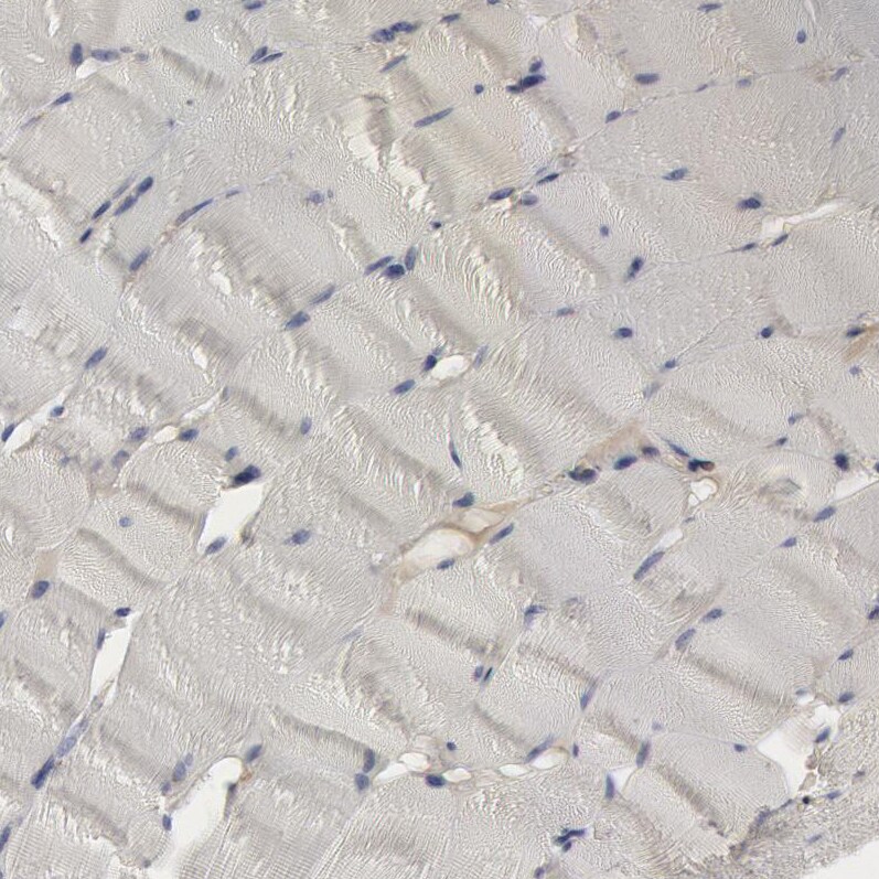 Complement Component C1qC Antibody - BSA Free Immunohistochemistry-Paraffin: Complement Component C1qC Antibody [NBP1-89885]