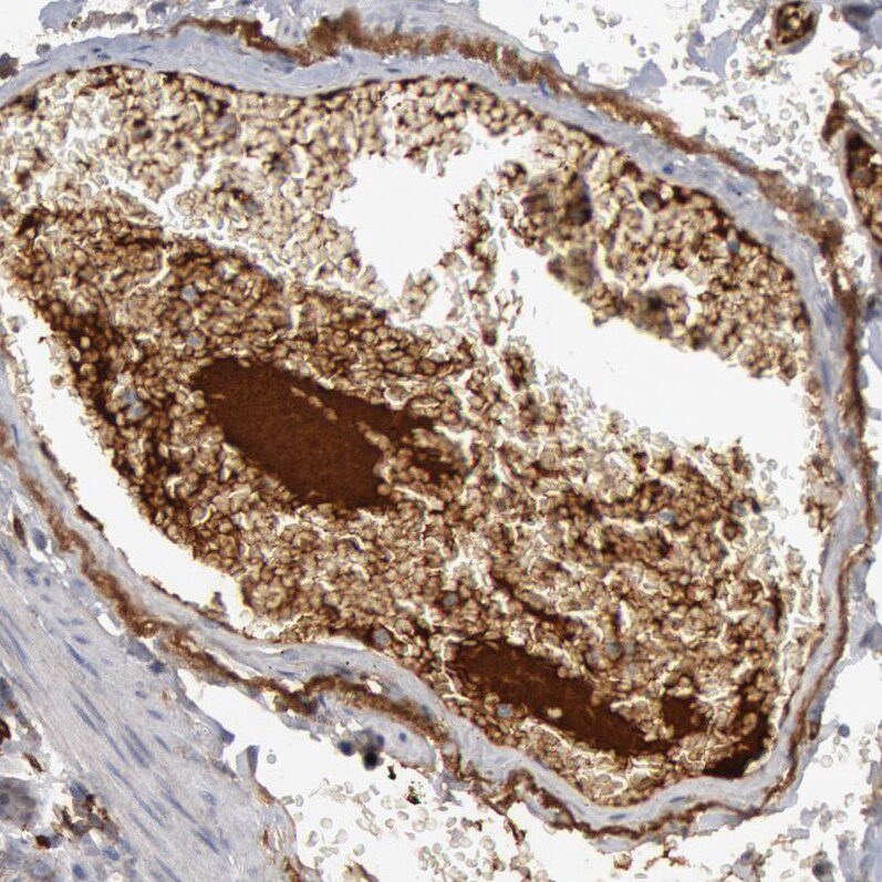 Complement Component C1qC Antibody - BSA Free Immunohistochemistry-Paraffin: Complement Component C1qC Antibody [NBP1-89885]