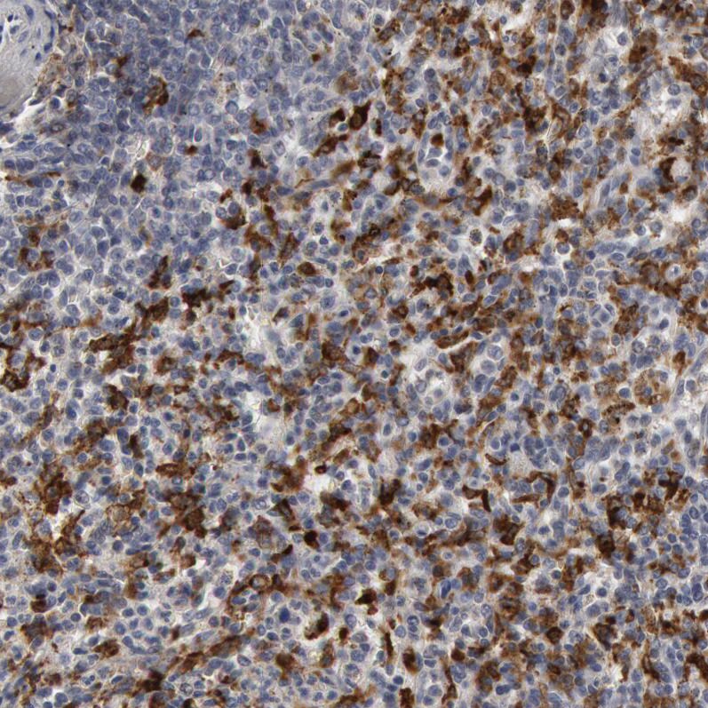 Complement Component C1qC Antibody - BSA Free Immunohistochemistry-Paraffin: Complement Component C1qC Antibody [NBP1-89885]