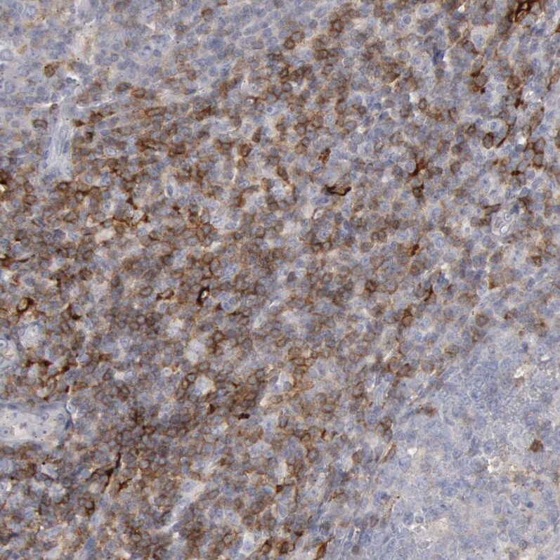 Complement Component C1qC Antibody - BSA Free Immunohistochemistry-Paraffin: Complement Component C1qC Antibody [NBP1-89885]