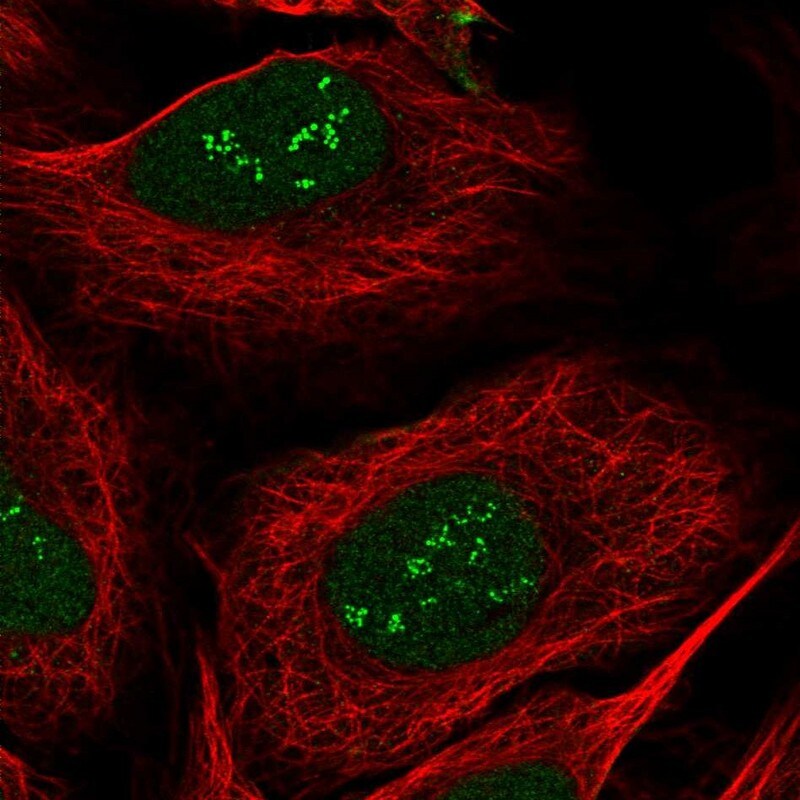 sen15 Antibody - BSA Free Immunocytochemistry/ Immunofluorescence: sen15 Antibody [NBP1-89888]
