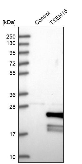 sen15 Antibody - BSA Free Western Blot: sen15 Antibody - BSA Free [NBP1-89888]