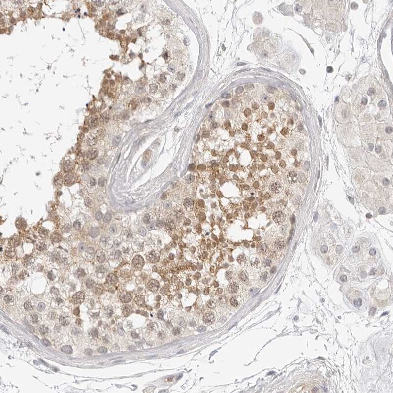 NOR1/OSCP1 Antibody - BSA Free Immunohistochemistry-Paraffin: NOR1/OSCP1 Antibody - BSA Free [NBP1-89889]