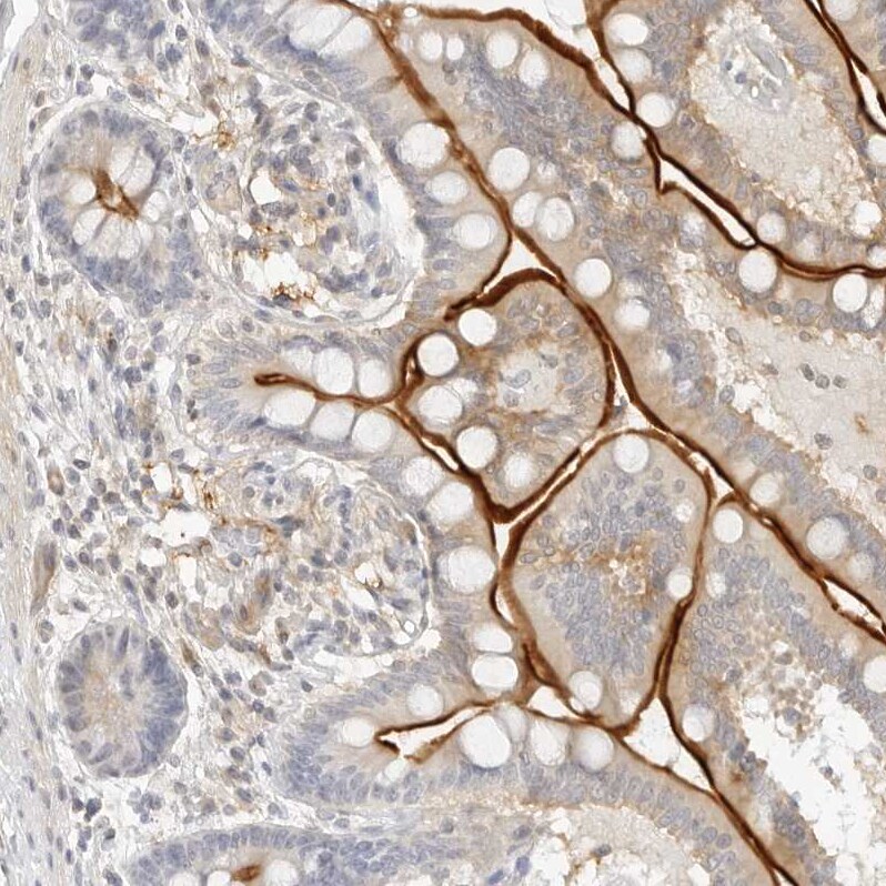 NOR1/OSCP1 Antibody - BSA Free Immunohistochemistry-Paraffin: NOR1/OSCP1 Antibody - BSA Free [NBP1-89889]