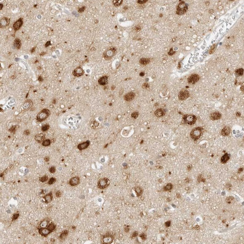 NOR1/OSCP1 Antibody - BSA Free Immunohistochemistry-Paraffin: NOR1/OSCP1 Antibody - BSA Free [NBP1-89889]