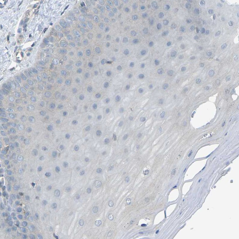 PIEZO2 Antibody - BSA Free Immunohistochemistry-Paraffin: PIEZO2 Antibody - BSA Free [NBP1-89893]