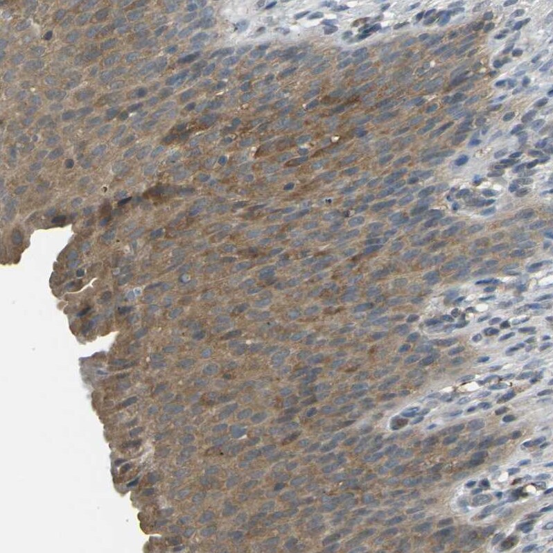 PIEZO2 Antibody - BSA Free Immunohistochemistry-Paraffin: PIEZO2 Antibody - BSA Free [NBP1-89893]
