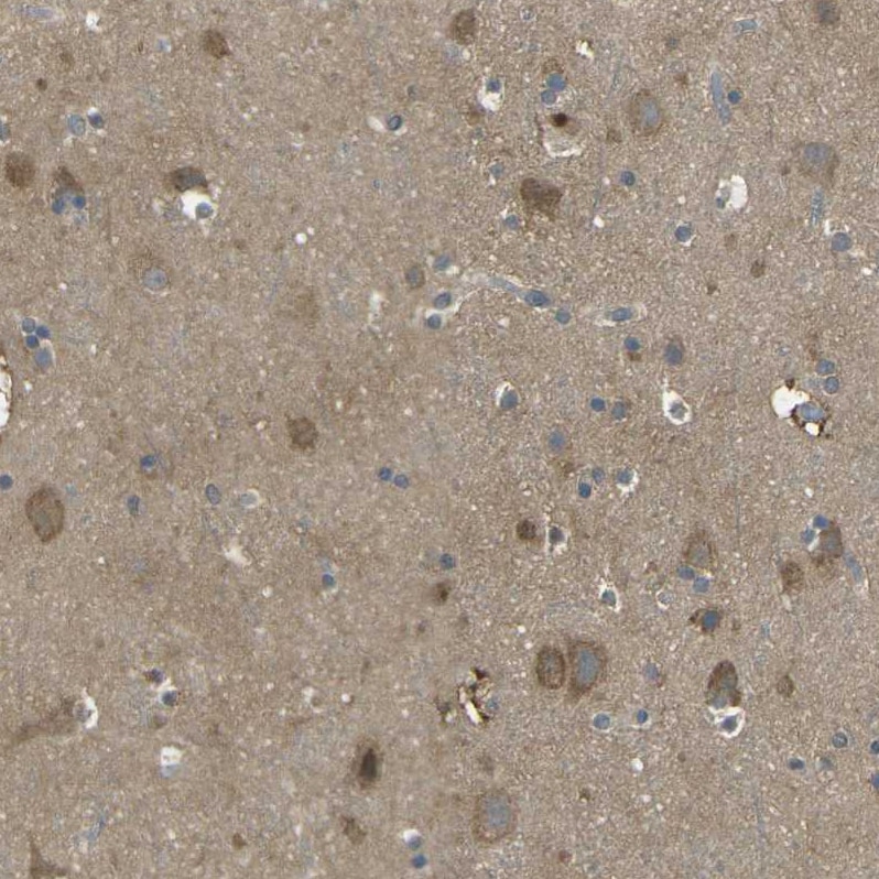 PIEZO2 Antibody - BSA Free Immunohistochemistry-Paraffin: PIEZO2 Antibody - BSA Free [NBP1-89893]