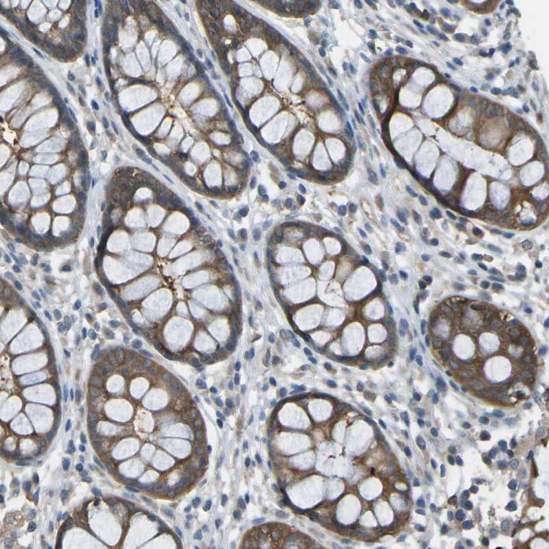 PIEZO2 Antibody - BSA Free Immunohistochemistry-Paraffin: PIEZO2 Antibody - BSA Free [NBP1-89893]