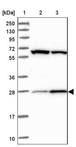 CEP27 Antibody - BSA Free Western Blot: CEP27 Antibody - BSA Free [NBP1-89895]