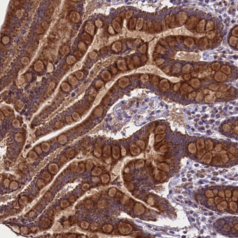 GLXR5 Antibody - BSA Free Immunohistochemistry-Paraffin: GLXR5 Antibody - BSA Free [NBP1-89897]