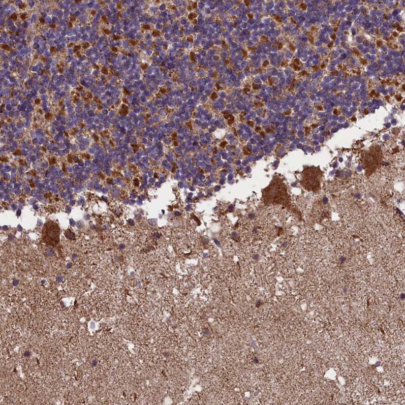 GLXR5 Antibody - BSA Free Immunohistochemistry-Paraffin: GLXR5 Antibody - BSA Free [NBP1-89897]