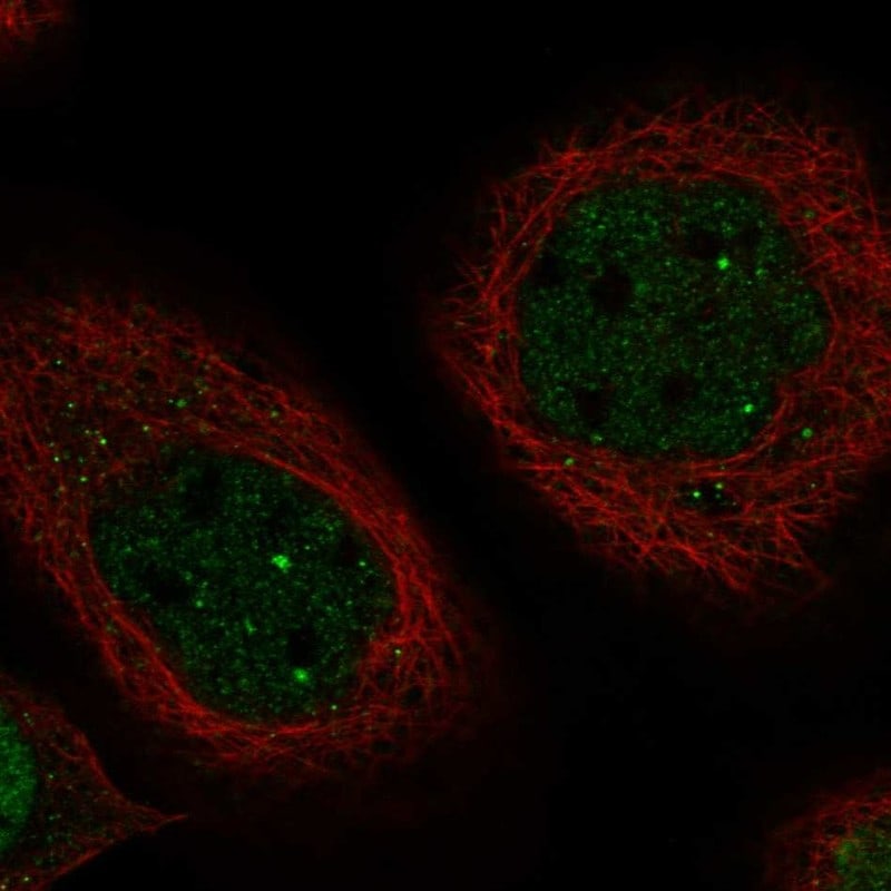 MTAC2D1 Antibody - BSA Free Immunocytochemistry/ Immunofluorescence: MTAC2D1 Antibody - BSA Free [NBP1-89900]