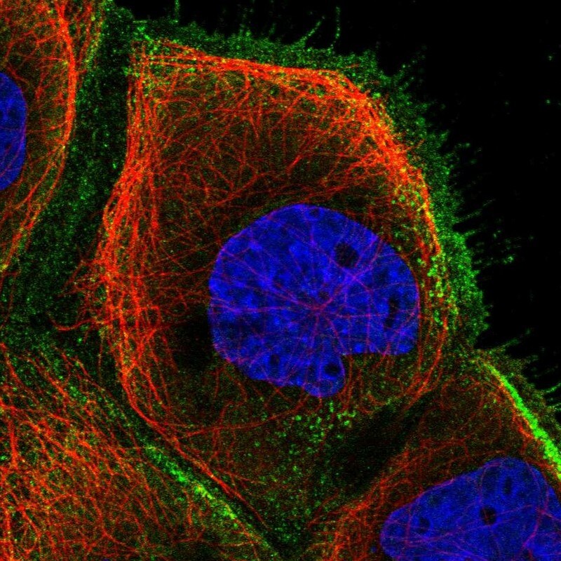 NY-REN-50 antigen Antibody - BSA Free Immunocytochemistry/ Immunofluorescence: NY-REN-50 antigen Antibody [NBP1-89903]