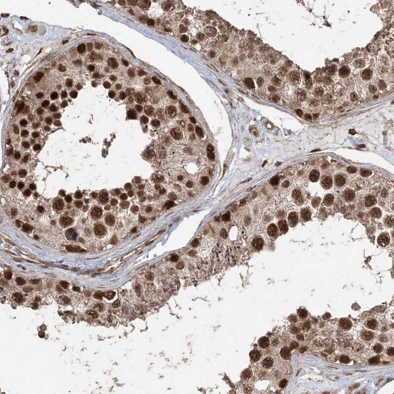 NY-REN-50 antigen Antibody - BSA Free Immunohistochemistry-Paraffin: NY-REN-50 antigen Antibody - BSA Free [NBP1-89903]