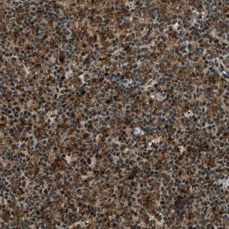 KNL-2 Antibody - BSA Free Immunohistochemistry-Paraffin: KNL-2 Antibody - BSA Free [NBP1-89905]