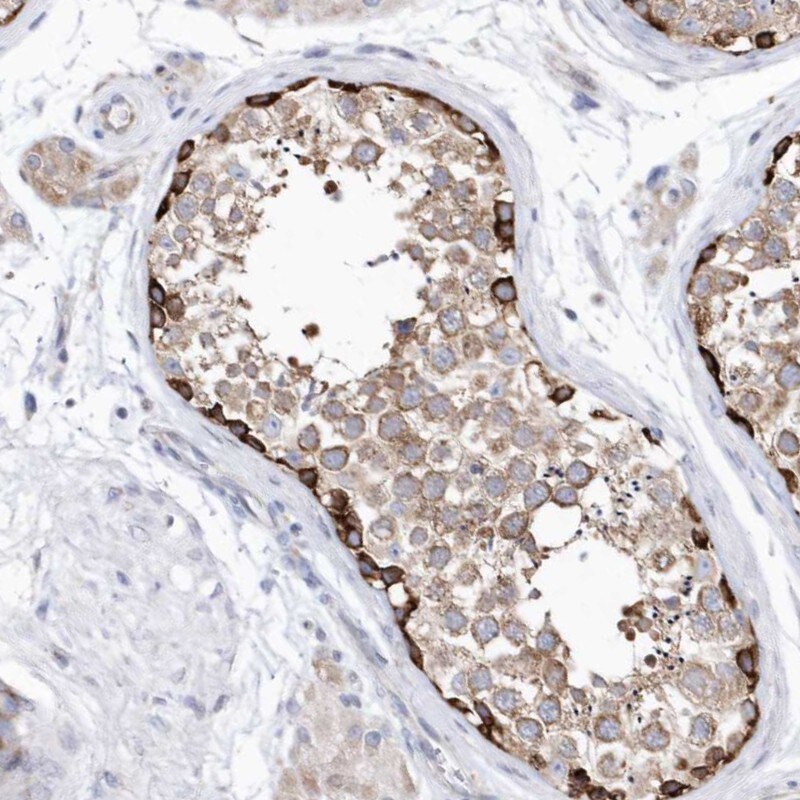 JAMP Antibody - BSA Free Immunohistochemistry-Paraffin: JAMP Antibody - BSA Free [NBP1-89906]