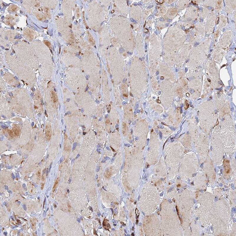 G5pr Antibody - BSA Free Immunohistochemistry-Paraffin: G5pr Antibody [NBP1-89907]