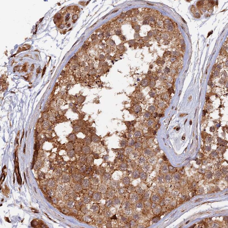 G5pr Antibody - BSA Free Immunohistochemistry-Paraffin: G5pr Antibody [NBP1-89907]