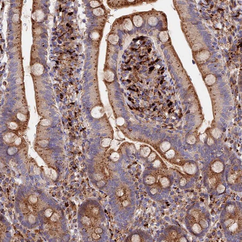 G5pr Antibody - BSA Free Immunohistochemistry-Paraffin: G5pr Antibody [NBP1-89907]