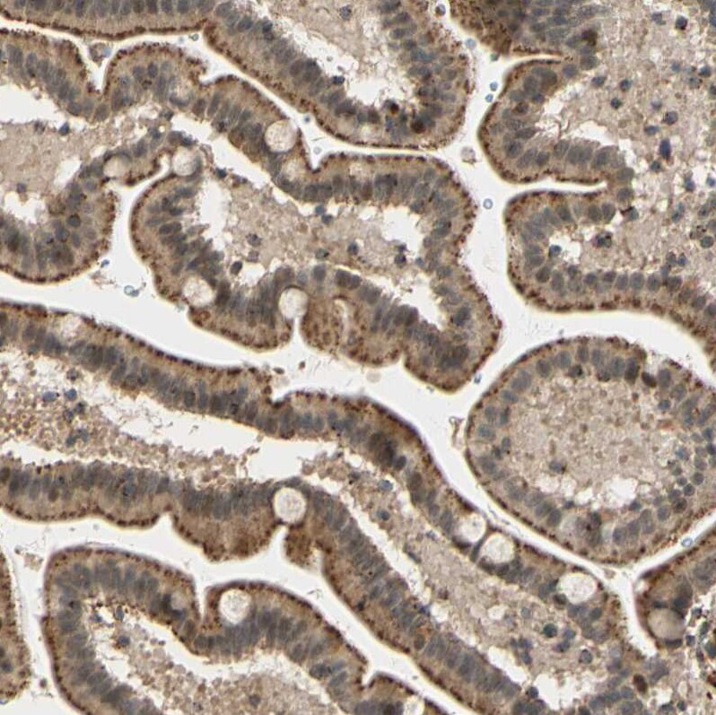 LAMTOR1 Antibody - BSA Free Immunohistochemistry: LAMTOR1 Antibody - BSA Free [NBP1-89909]
