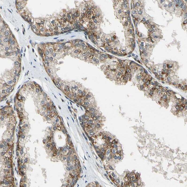 LAMTOR1 Antibody - BSA Free Immunohistochemistry: LAMTOR1 Antibody - BSA Free [NBP1-89909]