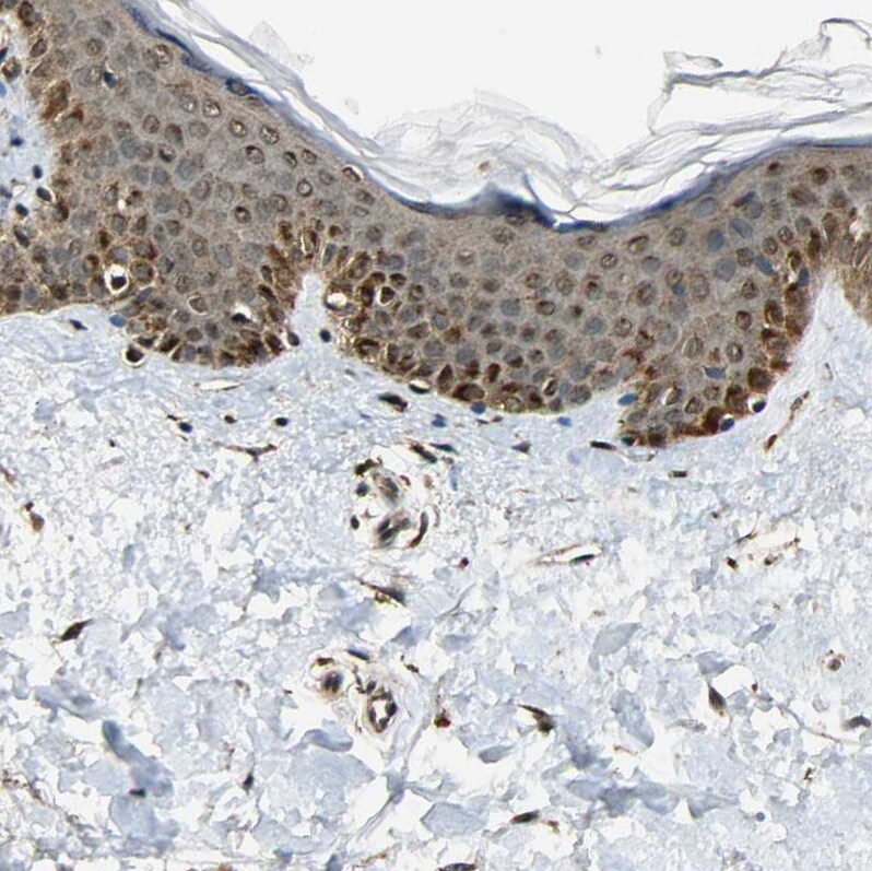 LAMTOR1 Antibody - BSA Free Immunohistochemistry: LAMTOR1 Antibody - BSA Free [NBP1-89909]