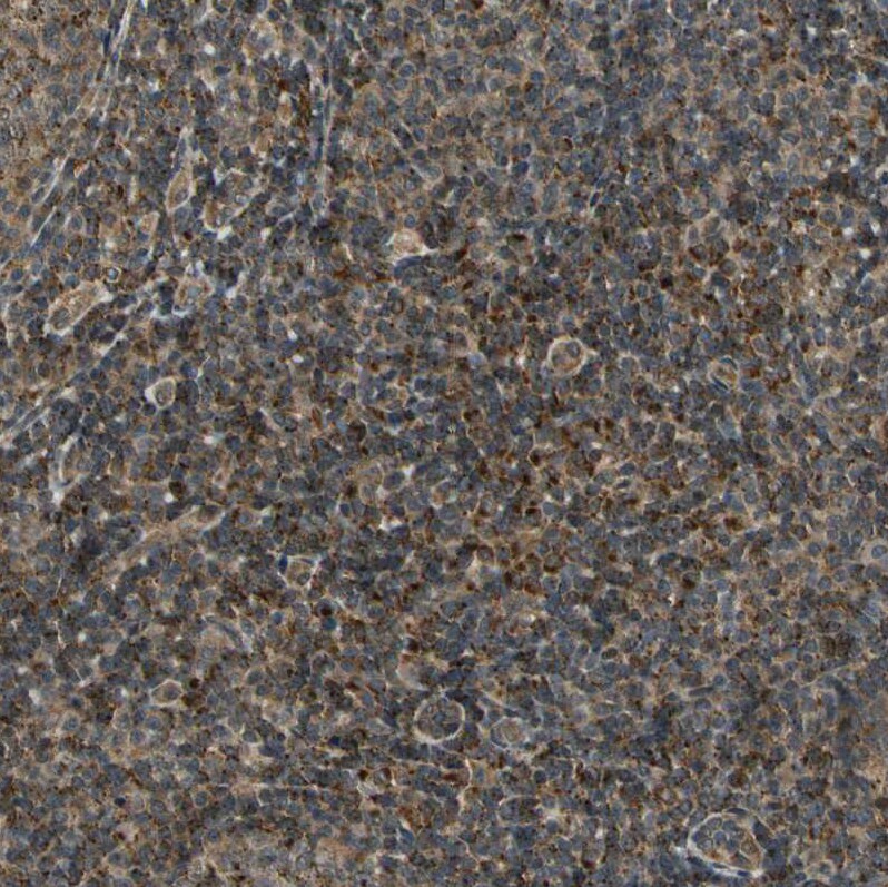 LAMTOR1 Antibody - BSA Free Immunohistochemistry: LAMTOR1 Antibody - BSA Free [NBP1-89909]