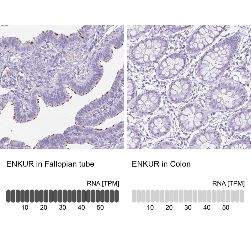 enkurin Antibody - BSA Free Immunohistochemistry-Paraffin: enkurin Antibody - BSA Free [NBP1-89911]