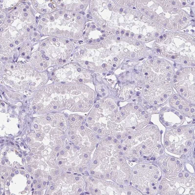 enkurin Antibody - BSA Free Immunohistochemistry-Paraffin: enkurin Antibody - BSA Free [NBP1-89911]