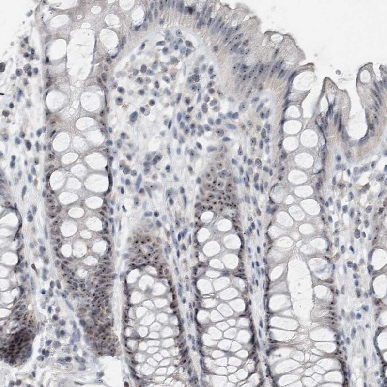 BXDC5 Antibody - BSA Free Immunohistochemistry-Paraffin: BXDC5 Antibody - BSA Free [NBP1-89915]