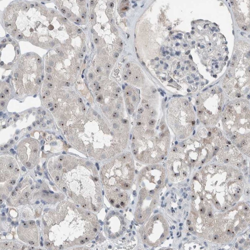 BXDC5 Antibody - BSA Free Immunohistochemistry-Paraffin: BXDC5 Antibody - BSA Free [NBP1-89915]