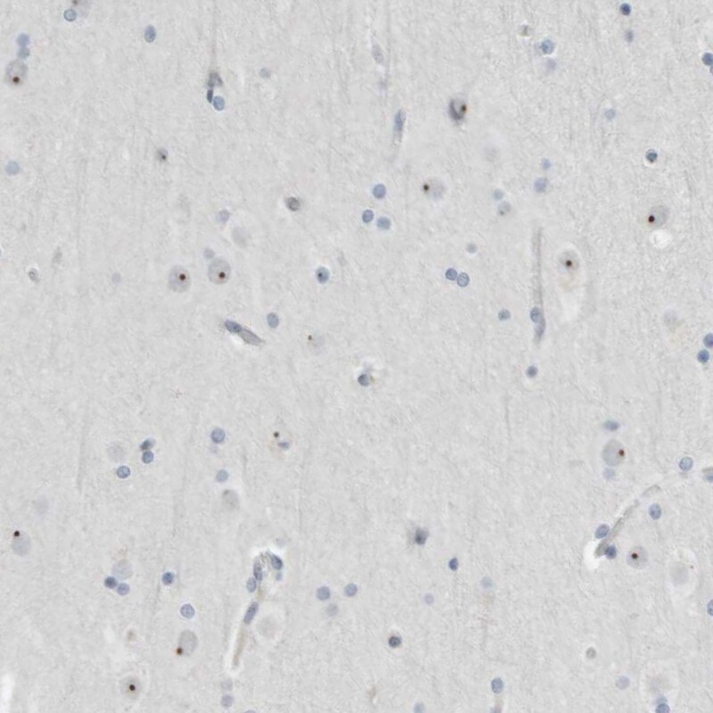 BXDC5 Antibody - BSA Free Immunohistochemistry-Paraffin: BXDC5 Antibody - BSA Free [NBP1-89915]