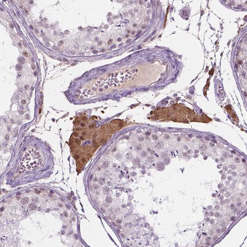 p57 Kip2 Antibody - BSA Free Immunohistochemistry-Paraffin: p57 Kip2 Antibody - BSA Free [NBP1-89917]