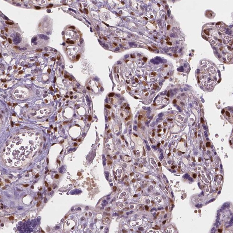 p57 Kip2 Antibody - BSA Free Immunohistochemistry-Paraffin: p57 Kip2 Antibody - BSA Free [NBP1-89917]