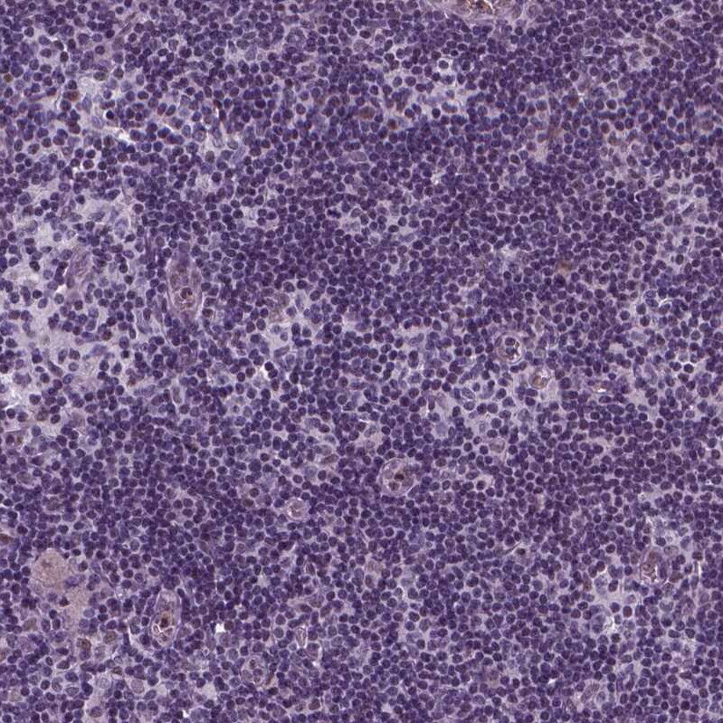 p57 Kip2 Antibody - BSA Free Immunohistochemistry-Paraffin: p57 Kip2 Antibody - BSA Free [NBP1-89917]