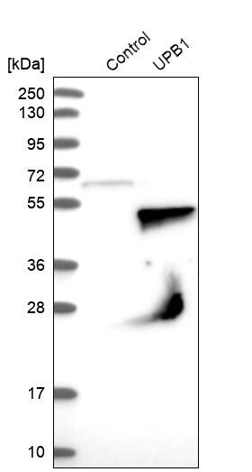 beta ureidopropionase Antibody - BSA Free Western Blot: beta ureidopropionase Antibody - BSA Free [NBP1-89918]