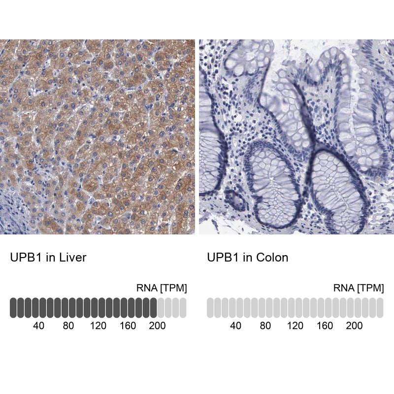 beta ureidopropionase Antibody - BSA Free Immunohistochemistry-Paraffin: beta ureidopropionase Antibody - BSA Free [NBP1-89918]