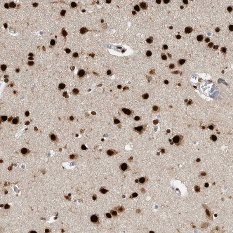 BTF Antibody - BSA Free Immunohistochemistry-Paraffin: BTF Antibody - BSA Free [NBP1-89924]